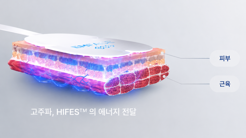 피부와 근육에 함께 전달되는 엠페이스 에너지를 표현한 단면 이미지