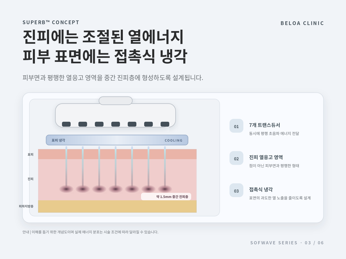7개 트랜스듀서의 평행 초음파와 접촉식 냉각을 설명한 SUPERB 개념도